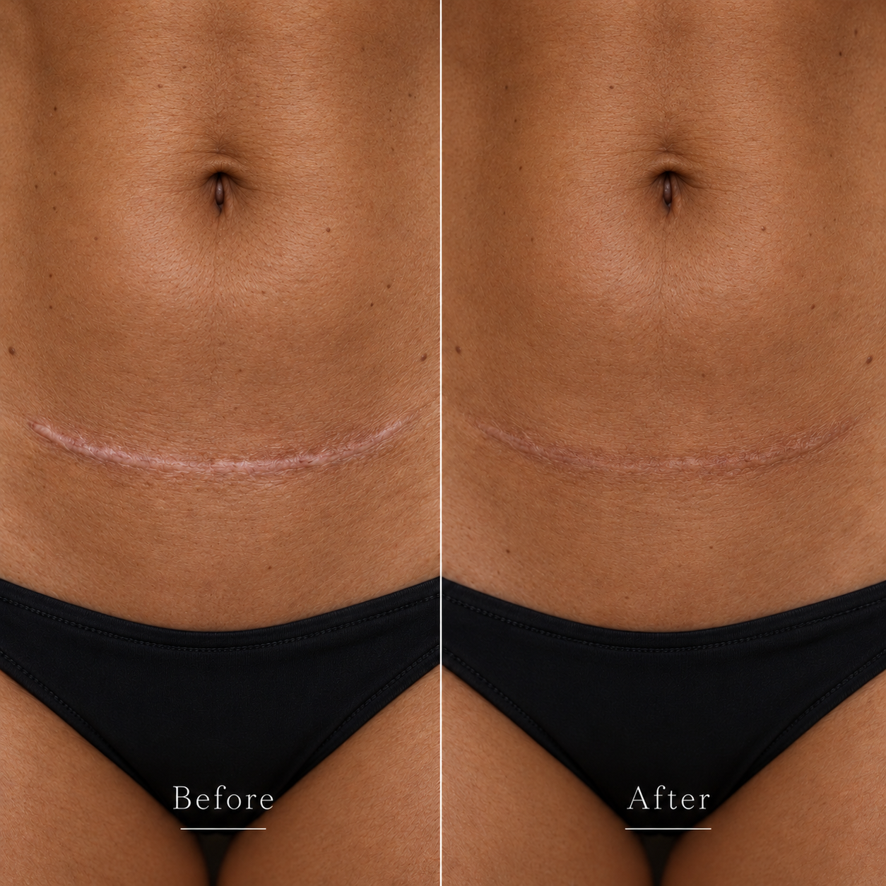 Before treatment