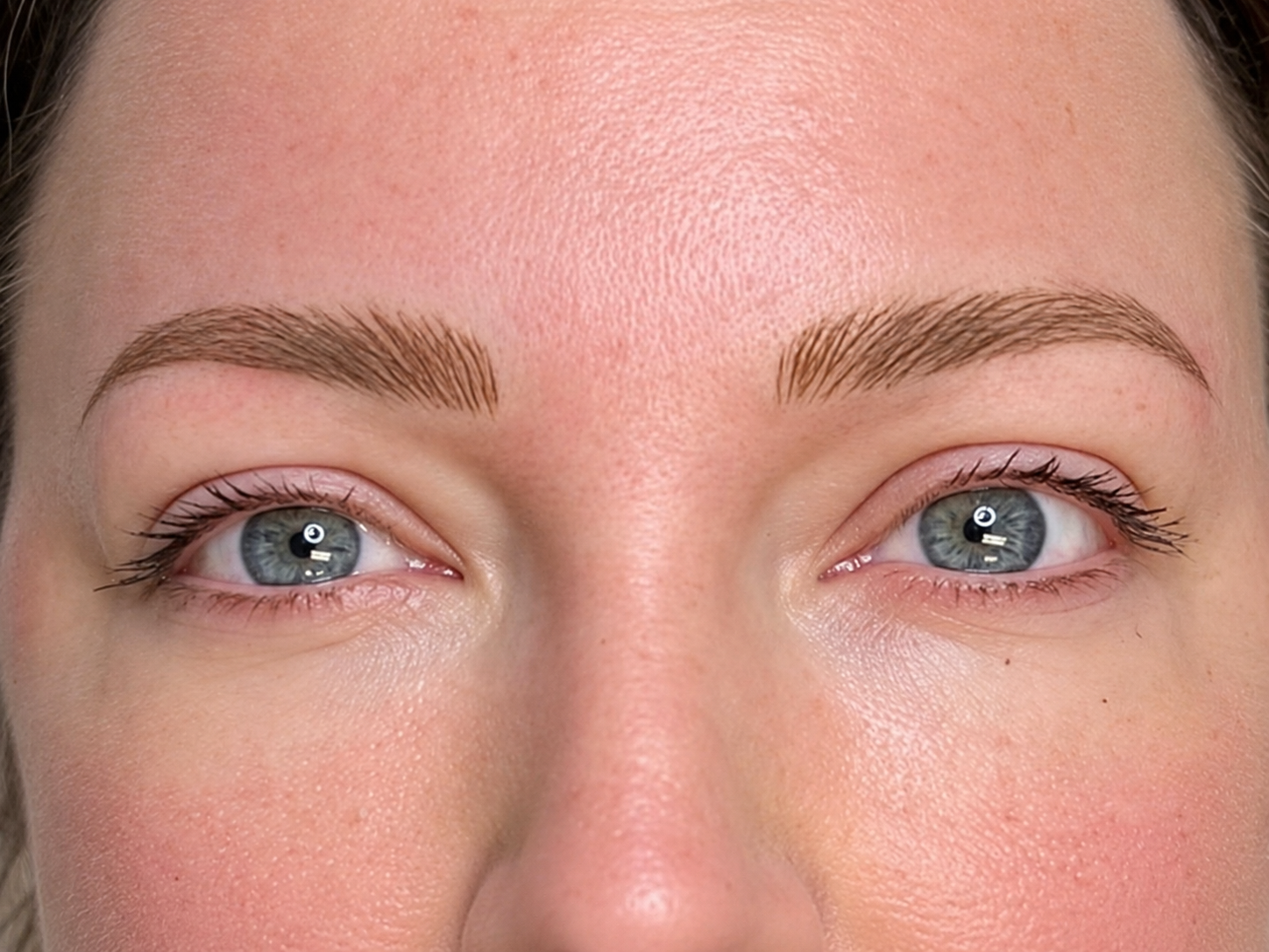 After treatment