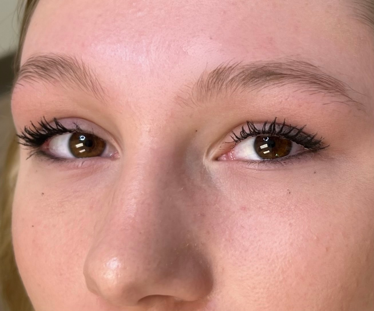 Before eyeliner treatment