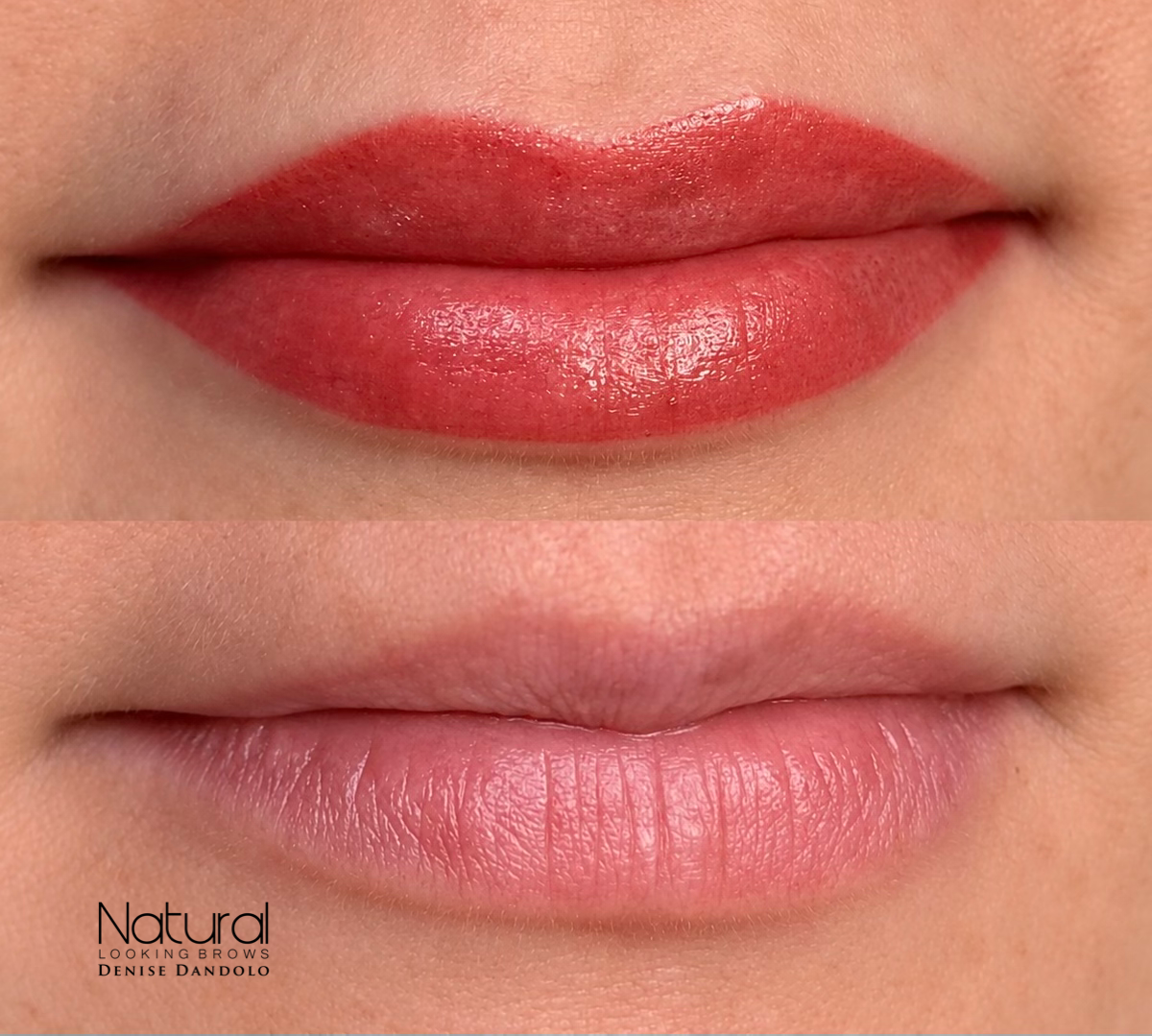 Lips result